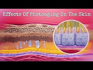 Effects Of Photoaging On The Skin