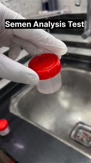 Understanding Sperm Analysis Through Microscopy