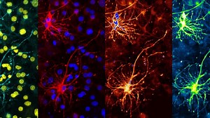 Neuralink: How The Human Brain Will Download Directly From a Computer – Lifeboat News: The Blog