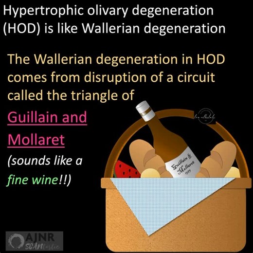 AJNR American Journal of Neuroradiology on Instagram: "COWABUNGA! If you see a ninja turtle staring at you, you may be looking at one of my FAVORITE radiology findings! This month’s @the_ajnr SCANtastic has all you need to know about this important pathology! https://www.ajnr.org/content/46/12/2582 Bright eyes of the ninja turtle are the ION. And they’re bright bc of hypertrophic olivary degeneration (HOD). HOD is how ION degenerates when input is disrupted. Signals from the red nucleus to ION a