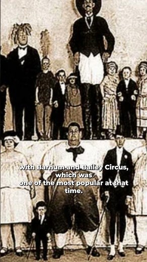 The Lady Born With Four Legs: Myrtle Corbin