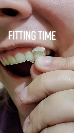 Vampire Fangs Theater Roleplay: Fitting and Fixing Process