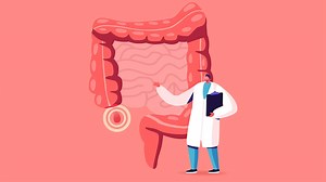 What Patients Should Know About Appendix Cancer? Expert Explains