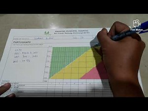 HOW TO PARTOGRAPH / LABOR MONITORING