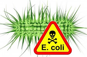 Waspada Bakteri E. Coli, Kenali Lebih Dekat dan Ketahui Penyebarannya, Bisa Sangat Berbahaya loh!