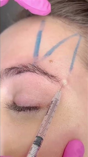 Skin Transformation @Puar.Medspa in Lake Mary. #Shorts