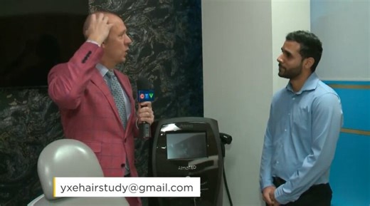 U of S hair restoration research could grow on you