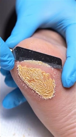 Foot ASMR Deep Relief | Heel Scrape Detail