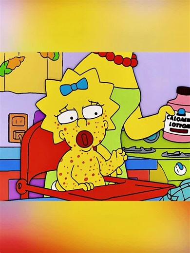 Hilarious Chicken Pox Adventure in The Simpsons