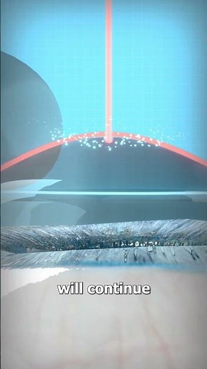 How Lasik Surgery Works 👀