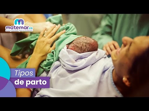 Tipos de parto: ¿Cómo prepararte para el nacimiento de tu bebé? | Maternar.co