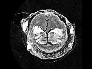 Micro-CT scan (cross-sections) of Hermodice carunculata (Polychaeta, Amphinomidae)