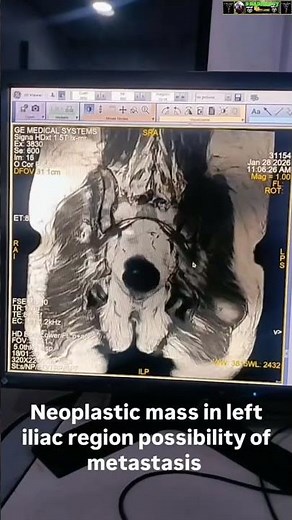 MRI PELVIC REGION #anatomy