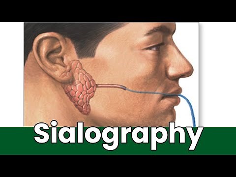 What Is Sialography: Overview, Uses, And The Procedure? How Is Sialography Done?