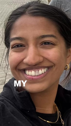 Overcoming Dental Fears: My Experience with Invisalign