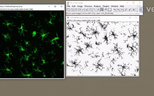 JoVE科研视频-使用ImageJ-免疫组织化学制备-量化小胶质细胞形态
