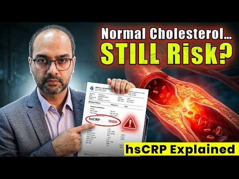 Normal Cholesterol But High Risk? The Truth About hsCRP & Heart Attacks