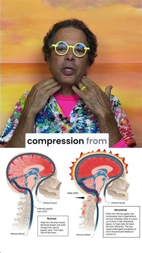 Yes, excessive sweating- hyperhydrosis, can be caused by neck instability