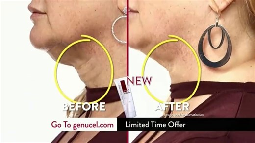 Genucel Jawline Treatment TV Spot, 'Reality Check: 70% Off'