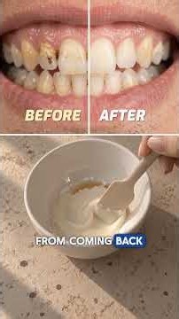 The #1 Anti-Tartar Toothpaste Recipe