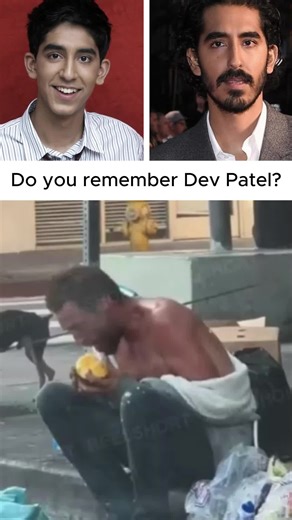 Dev Patel: From Slumdog to Hollywood Star