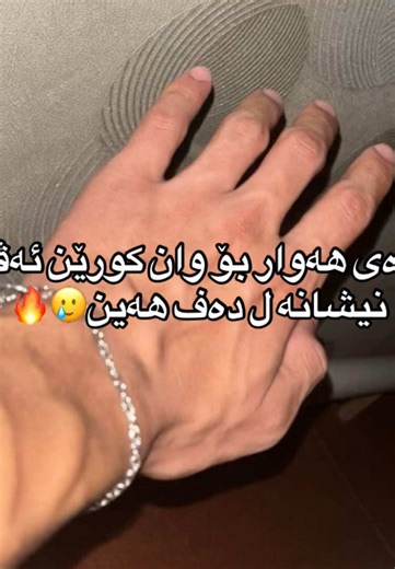 ‏🥲🔥#Hand_veins #Veins#foryou #viral #fyp @TikTok @For You