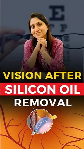 Vision Recovery After Silicon Oil Removal