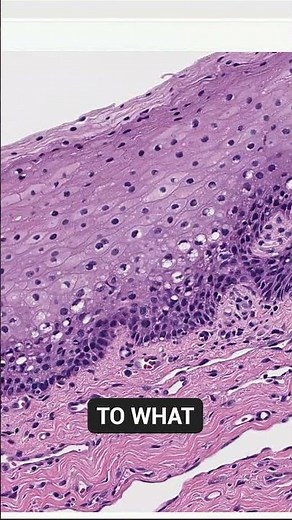 PHARYNGEAL TONSILS | Paletine Tonsil under the microscope