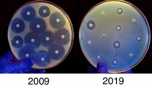 Prueba de difusión en disco (Kirby Bauer)