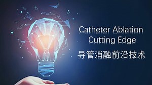 TactiCath Ablation Catheter,
