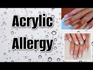 Did my nail products give me an allergy??? ( what to do)2025