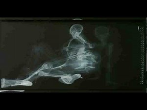 Total Crazy - X-Ray Pinup Girls !