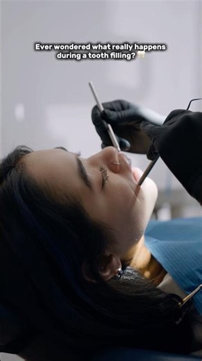 What Really Happens During a Tooth Filling? 🦷