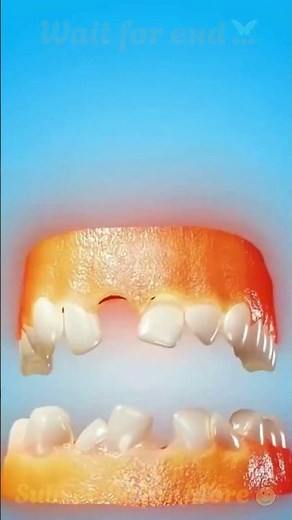 😬 The Truth About Your Teeth Falling Out! #Viral #ScienceFacts