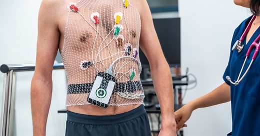 Holter cardíaco: qué es, para qué sirve y cómo se coloca