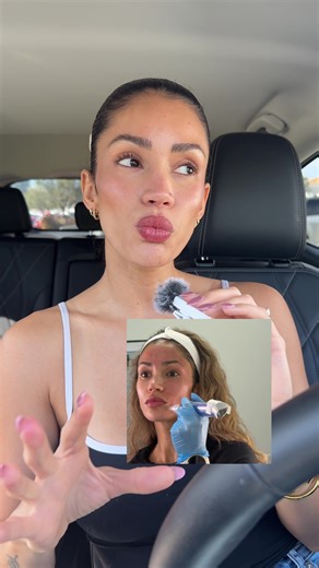 2026 Bride's Wedding Skin Prep: Microneedling Guide