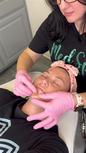 Come do a VI Peel with us🤩 Stay tuned for the peeling process! Our VI Peels are on sale this month for $199 (regular $299) Call us to purchase! 225-647-2292 | The Med Spa of Ascension