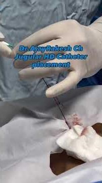 HD Catheter placement