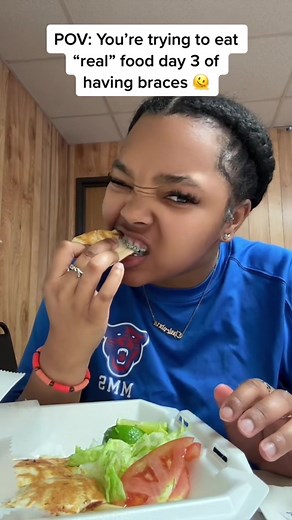 Benefits of Clear Aligners for Teeth Straightening