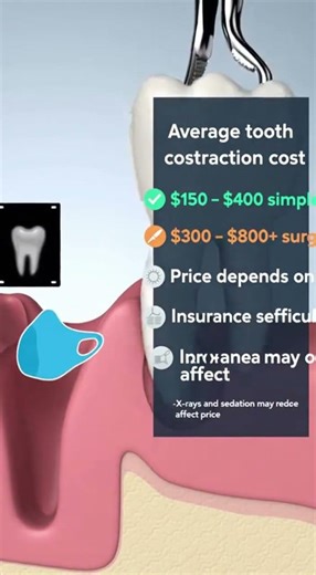 💰 How much does a tooth extraction cost?