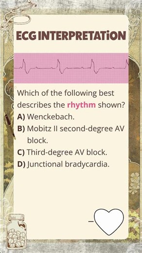 EKG\\ECG Interpretation Practice Exam #ekg