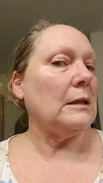 Day 2 Fluorouracil 5% Treatment Basal Cell Carcinoma Actinic Keratosis 1-6-23 (5-FU, Efudex)
