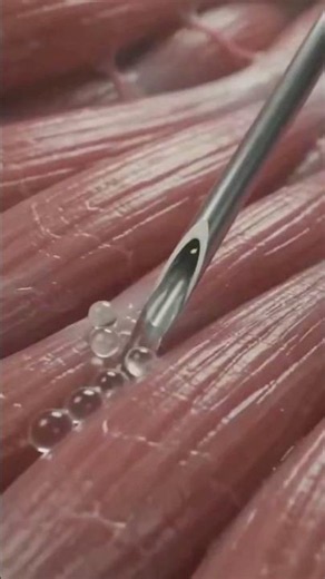 Injection 💉 process #iminjection #iminjection #hospital #dexone #hospital #ceftriaxone#dexamethasone