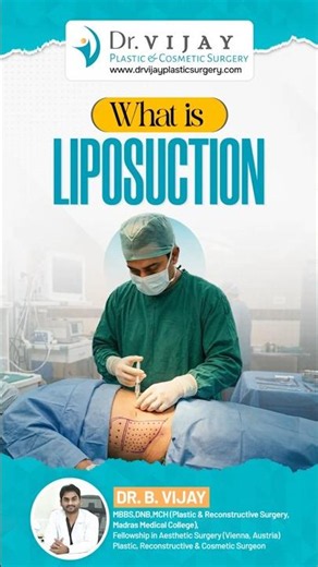 What is Liposuction? Advanced Fat Removal & Body Contouring Explained | Dr. Vijay