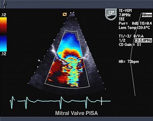 カラードップラー超音波：目的、準備、手順、結果 - Dvt 2026
