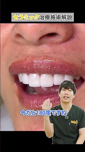 【湘南美容クリニック福岡院歯科】セラミック治療解説