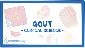 Gout: Video & Meaning | Osmosis