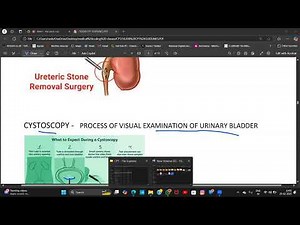 🩺 CPT 50K Series | Genitourinary & Endocrine System Coding Made Easy 🔍