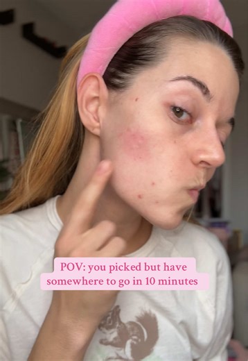 How to Deal with Skin Picking in Just 10 Minutes