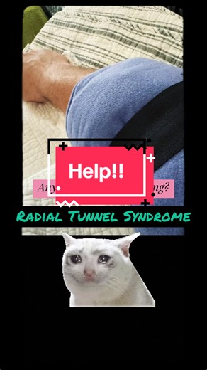 Radial Tunnel Syndrome: Tips for Faster Healing & Pain Relief
